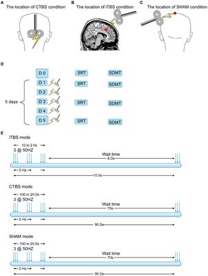 Theta burst stimulation on the fronto-cerebellar connective network promotes cognitive processing speed in the simple cognitive task